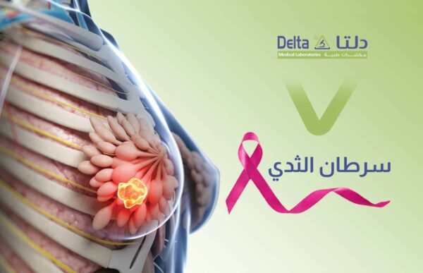 سرطان الثدي وأعراض سرطان الثدي ومراحله وطرق علاج سرطان الثدي