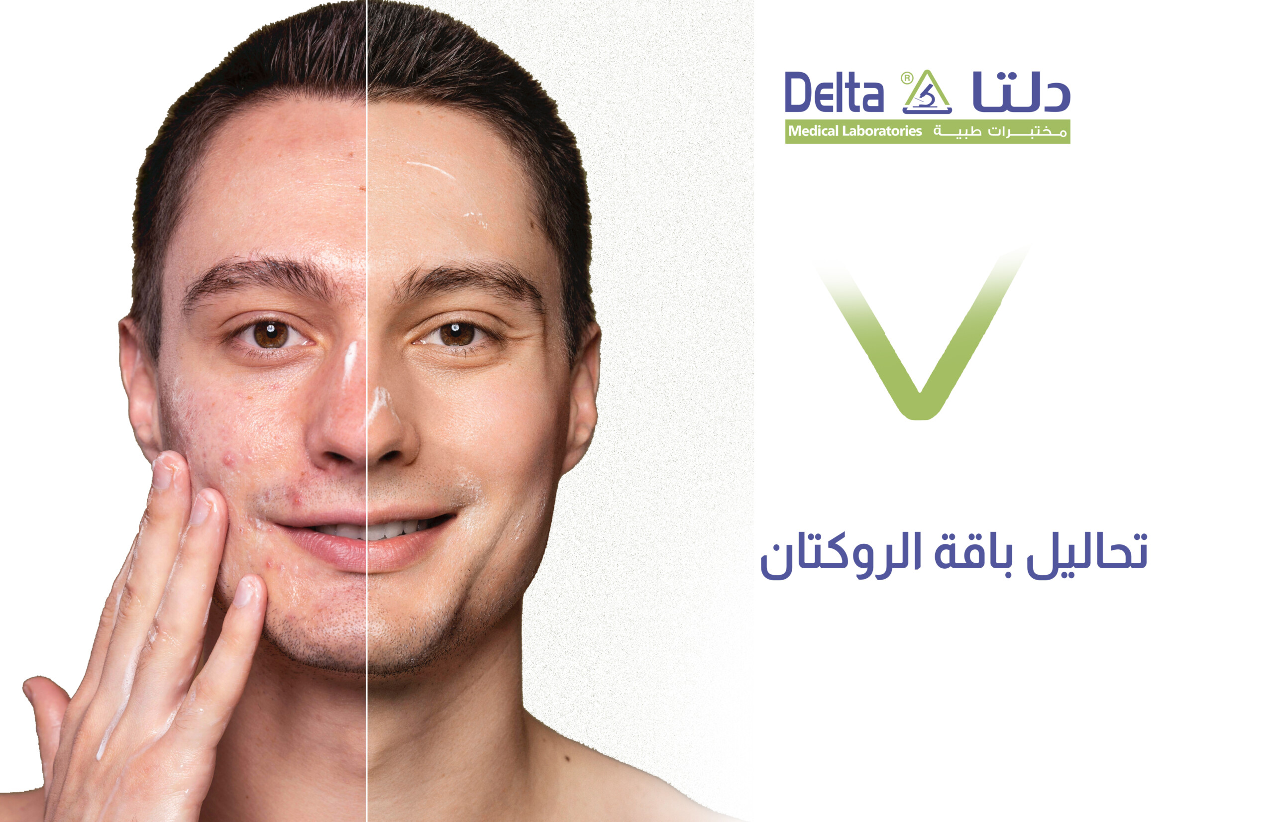 تحاليل باقة الروكتان