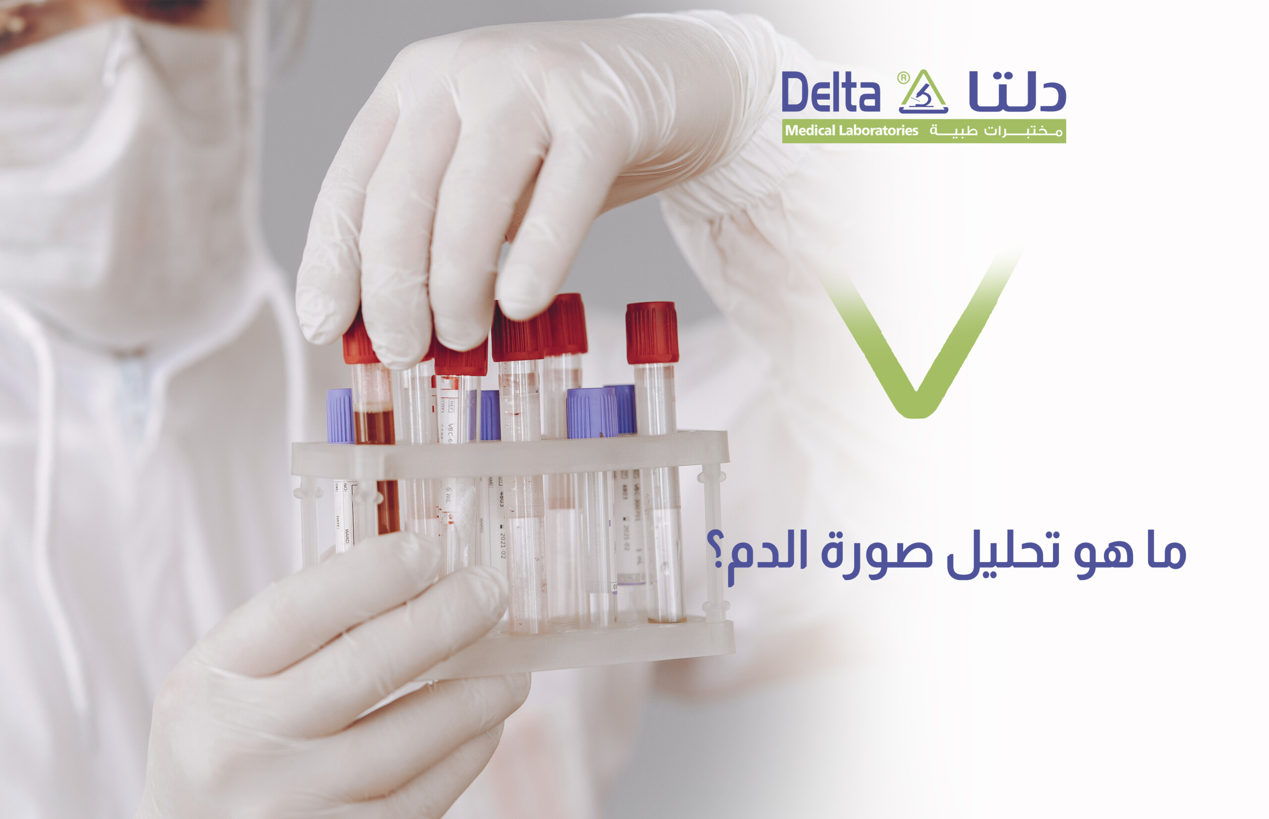 تحليل صورة الدم