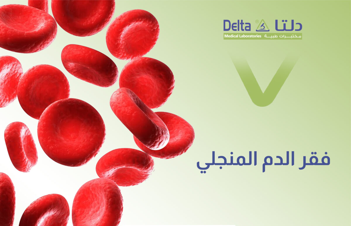 فقر الدم المنجلي ، تعريفه وأسبابه وعلاجه