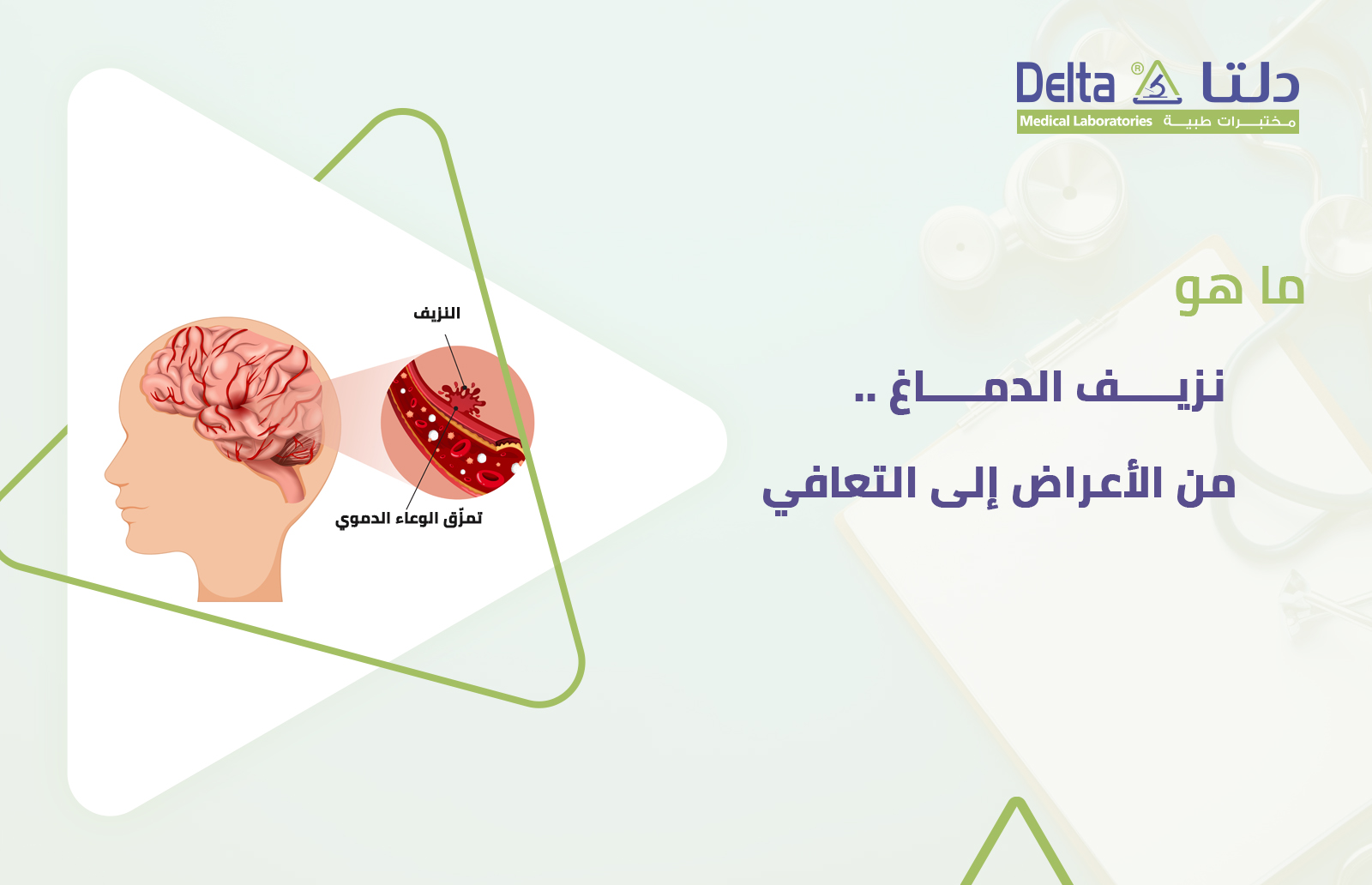 اكتشف أهم المعلومات حول نزيف الدماغ وأعراضه وأنواعه وأسبابه وطرق علاج نزيف الدماغ