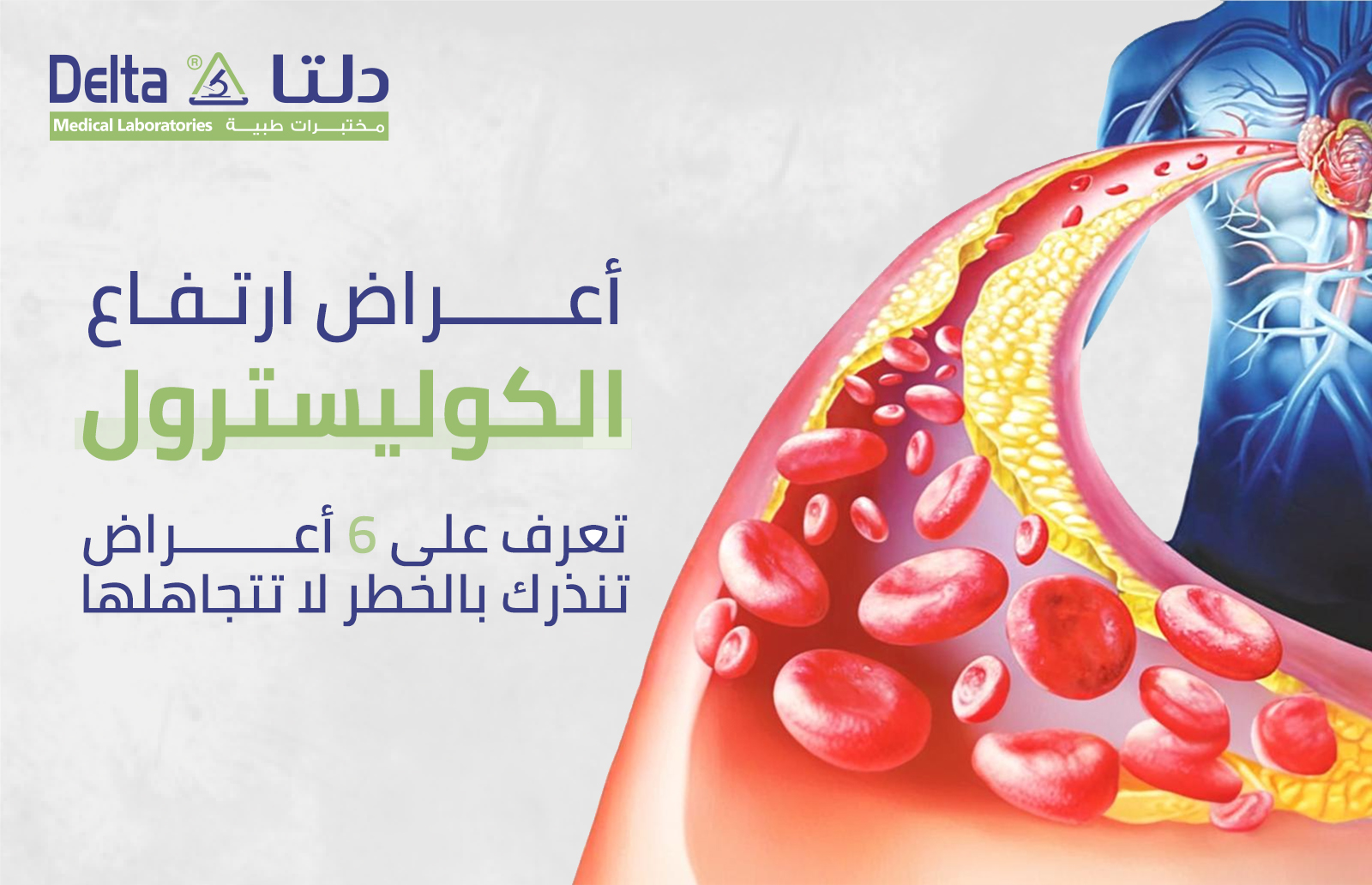 اعراض ارتفاع الكوليسترول تعرف على 6 أعراض لا تتجاهلها