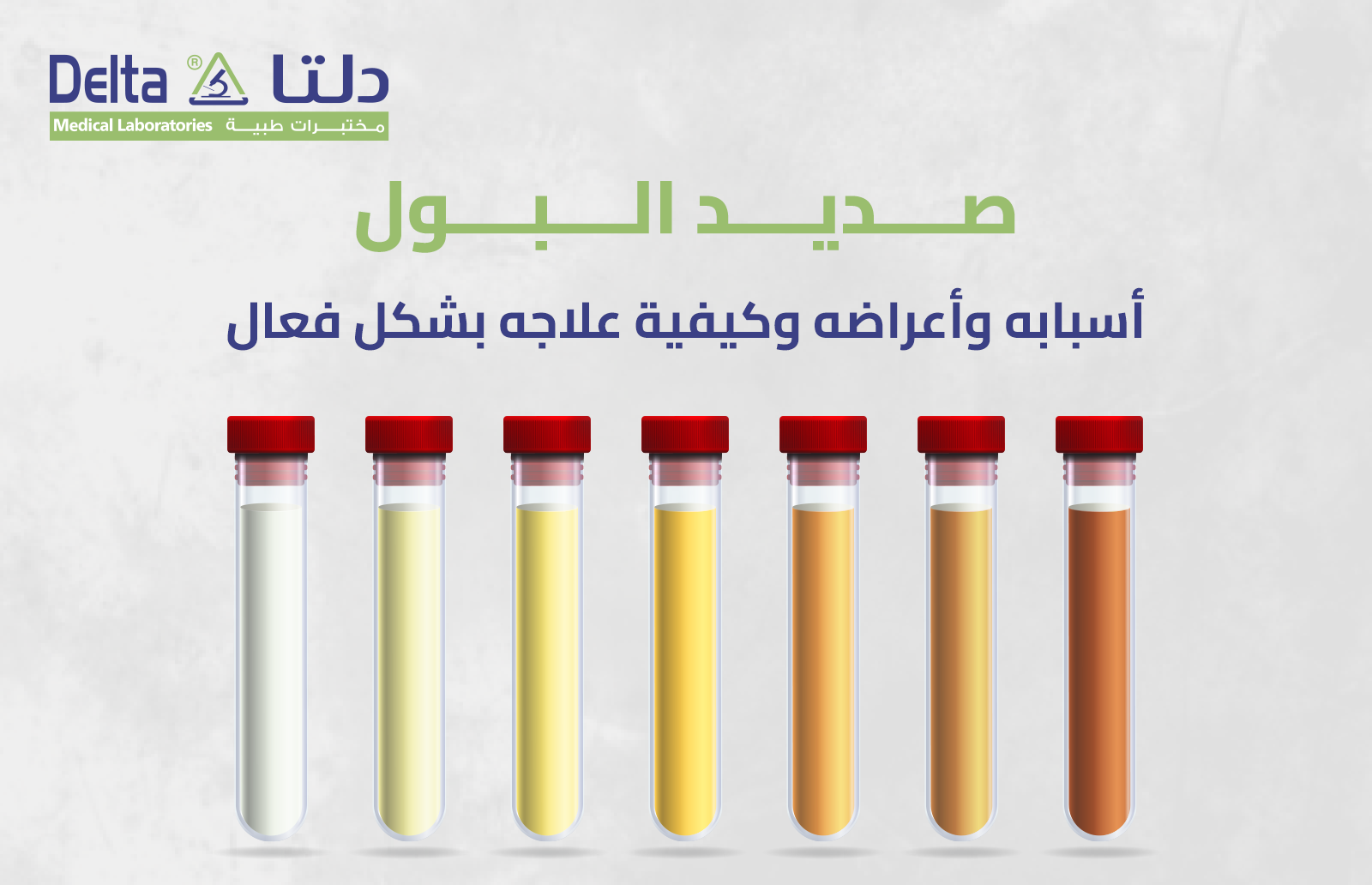 صديد البول: أسبابه وأعراضه وكيفية علاجه بشكل فعال