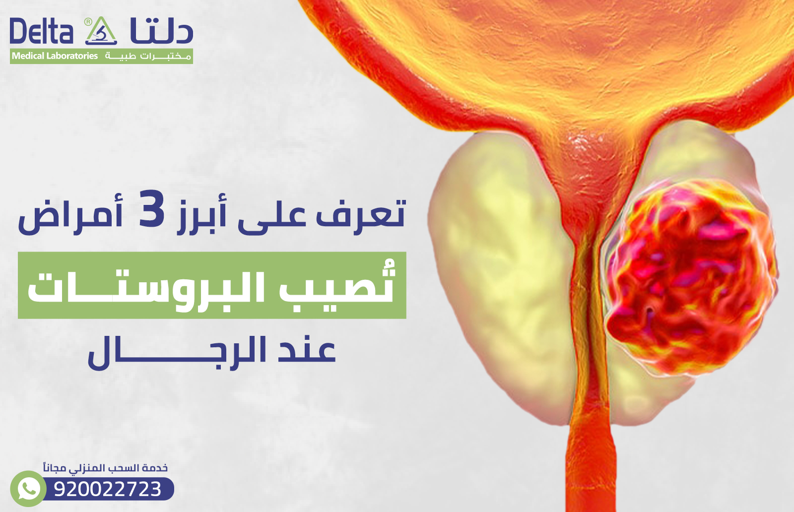 تعرف على أبرز 3 أمراض تُصيب البروستات عند الرجال