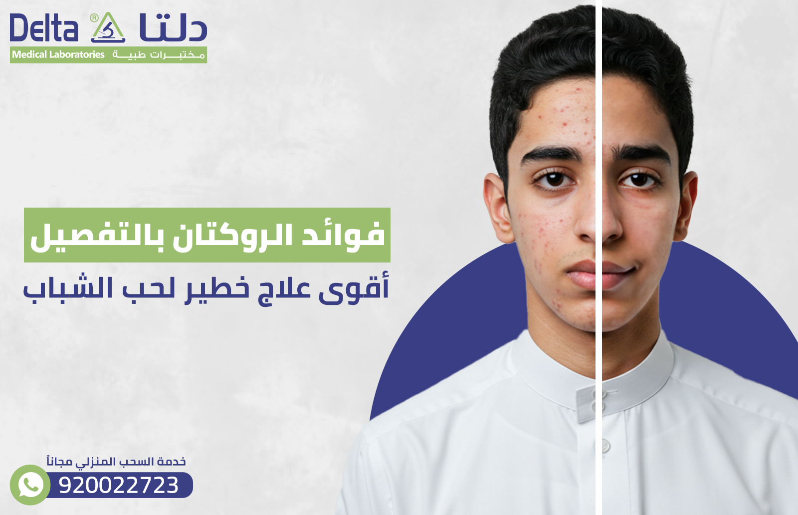 فوائد الروكتان بالتفصيل: تعرف على أقوى علاج خطير لحب الشباب