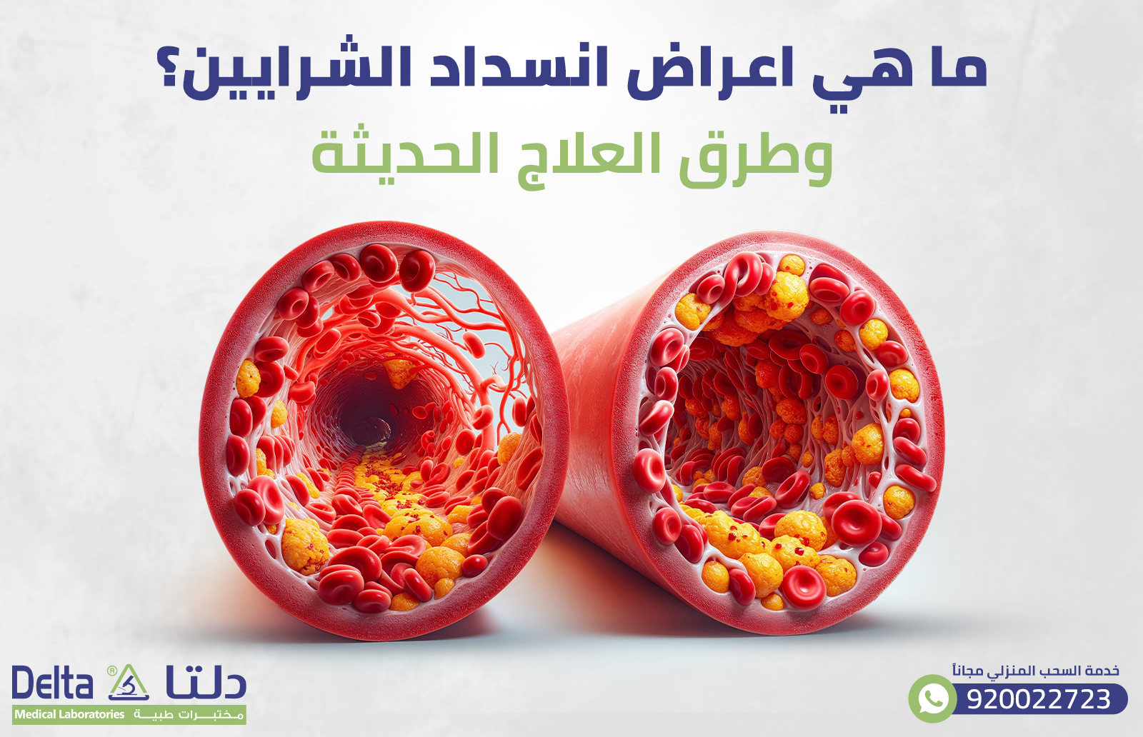 ما هي اعراض انسداد الشرايين؟ وطرق العلاج الحديثة