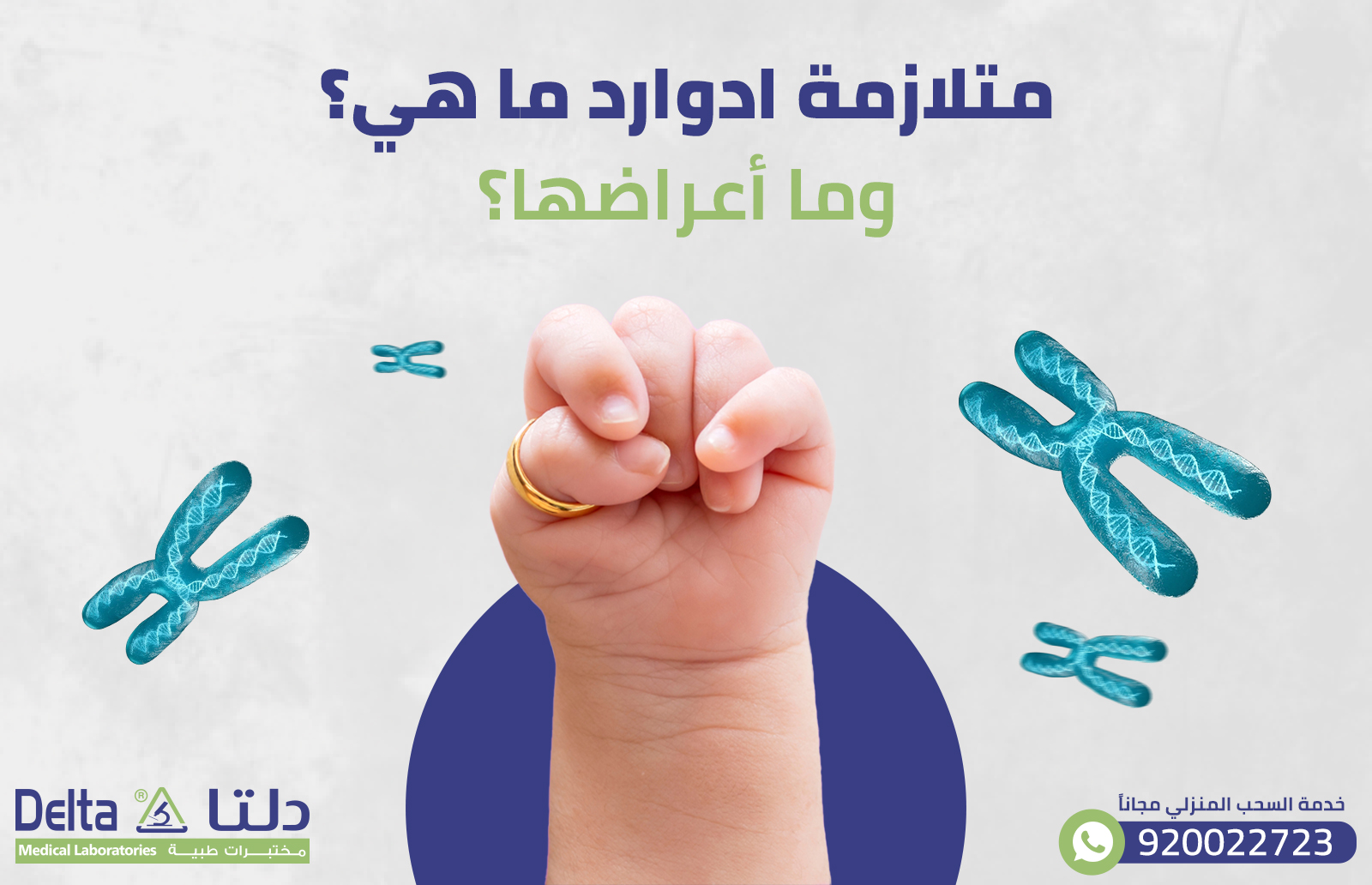 متلازمة ادوارد ما هي؟ وما أعراضها؟