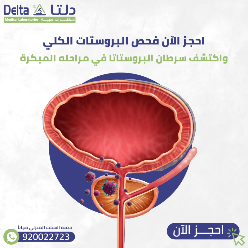 احجز الآن فحص البروستات الكلي واكتشف سرطان البروستاتا في مراحله المبكرة