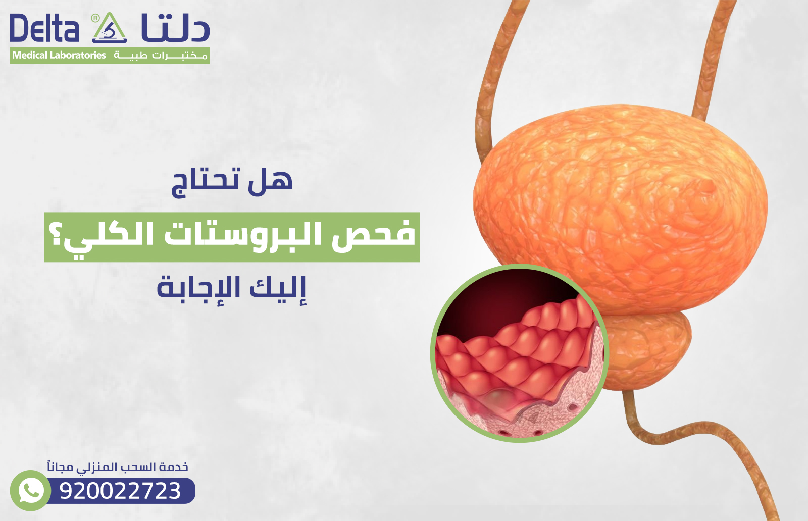 هل تحتاج إلى فحص البروستات الكلي؟ إليك الإجابة