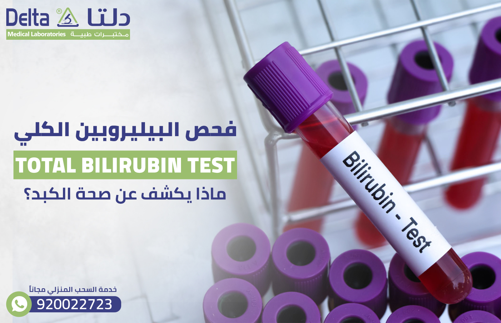 فحص البيليروبين الكلي: ماذا يكشف عن صحة الكبد؟