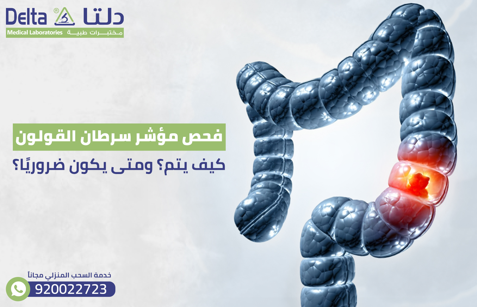 فحص مؤشر سرطان القولون : كيف يتم؟ ومتى يكون ضروريًا؟