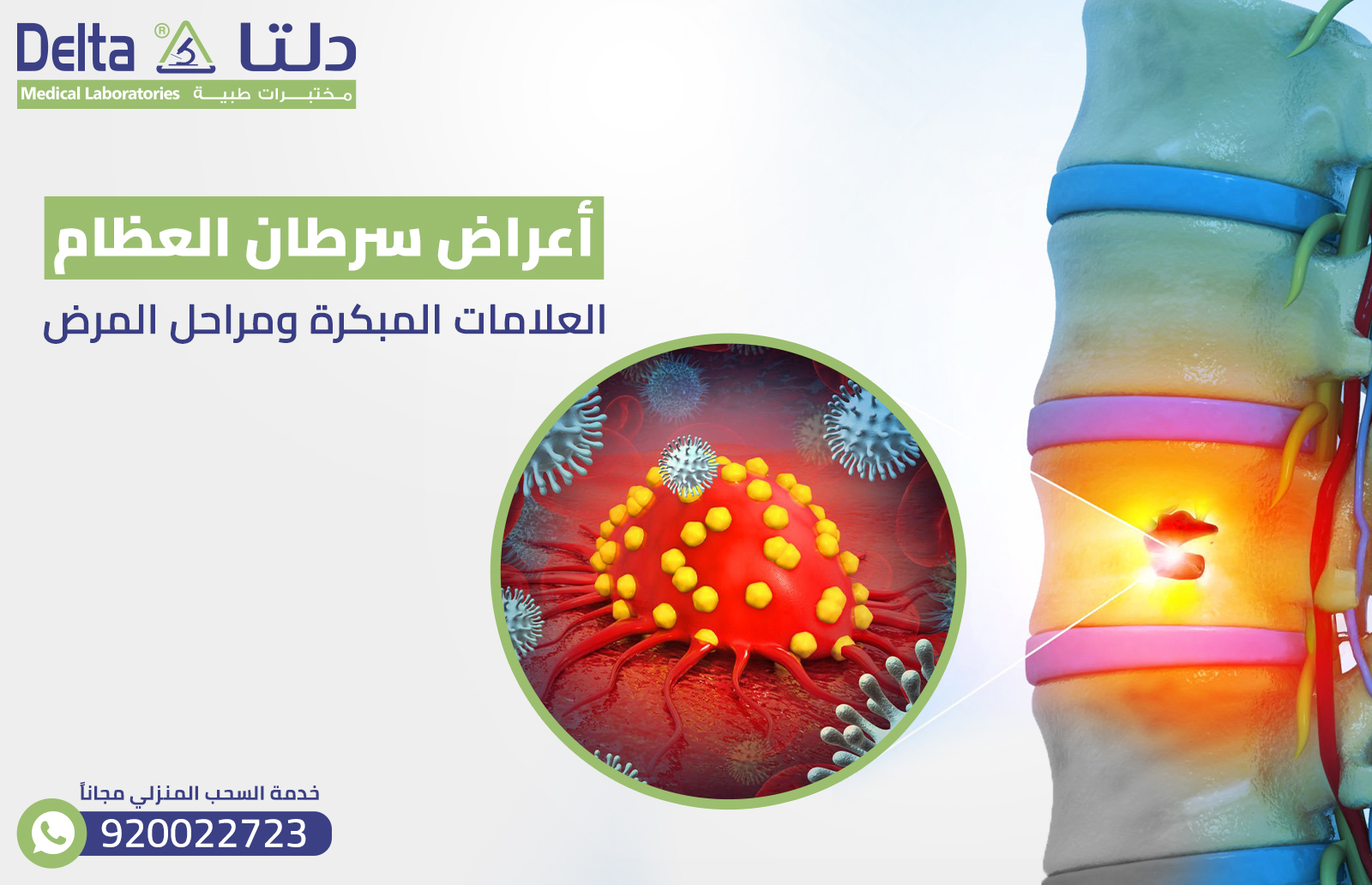 أعراض سرطان العظام : العلامات المبكرة ومراحل المرض