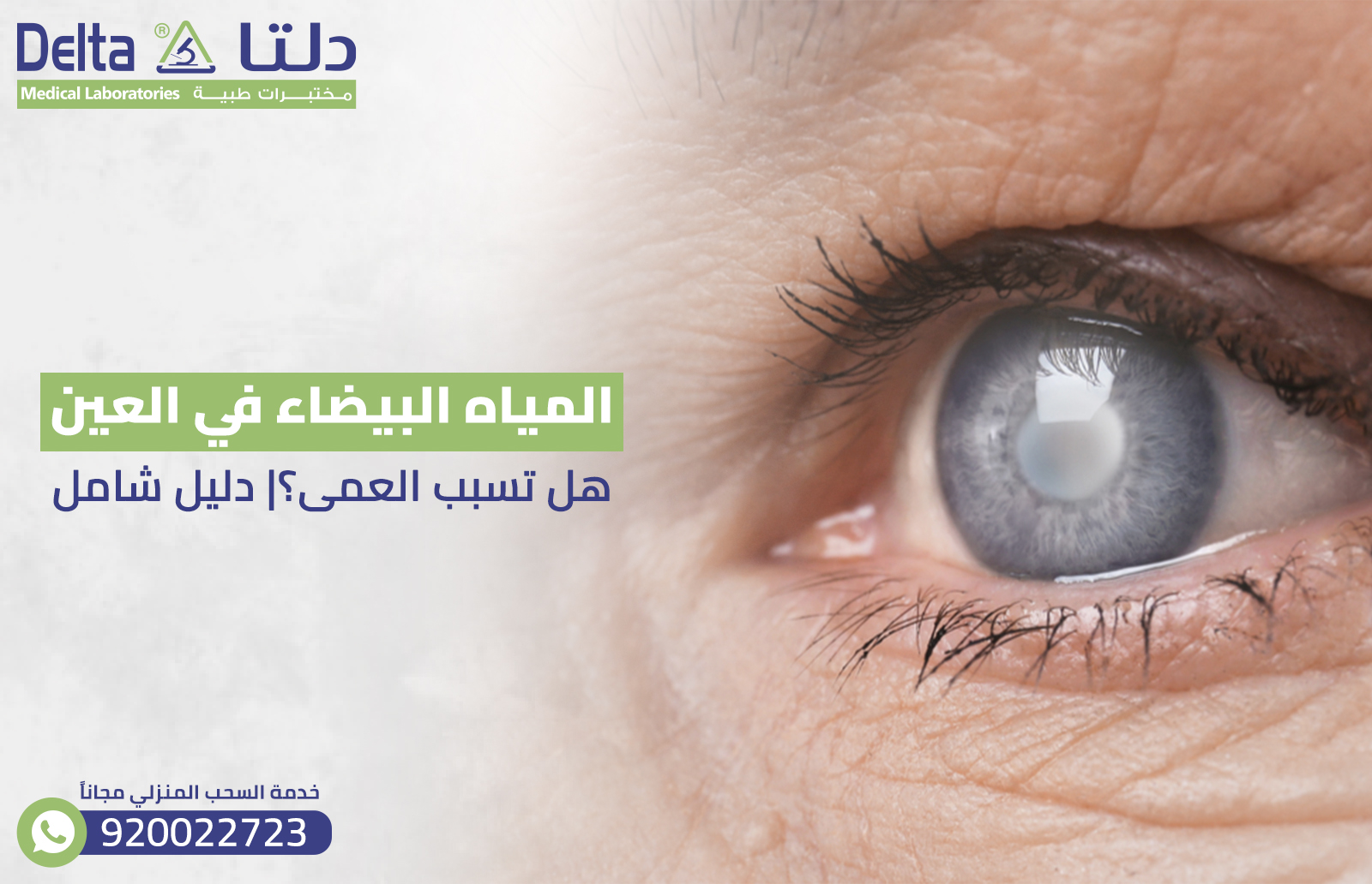 المياه البيضاء في العين : هل تسبب العمى؟| دليل شامل