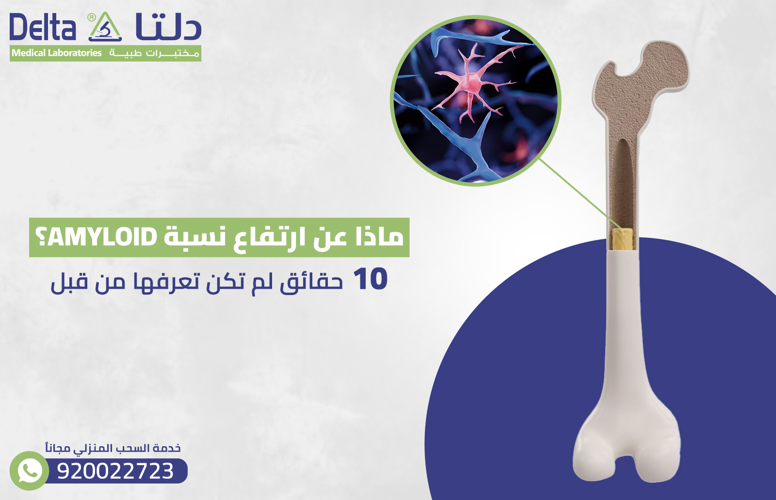 ماذا عن ارتفاع نسبة amyloid ؟ 10 حقائق لم تكن تعرفها من قبل