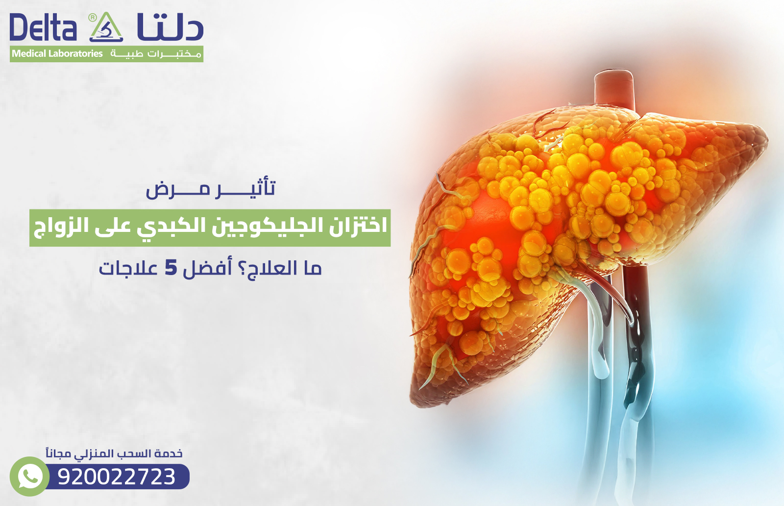 تاثير مرض اختزان الجليكوجين الكبدي على الزواج ما العلاج؟ أفضل 5 علاجات