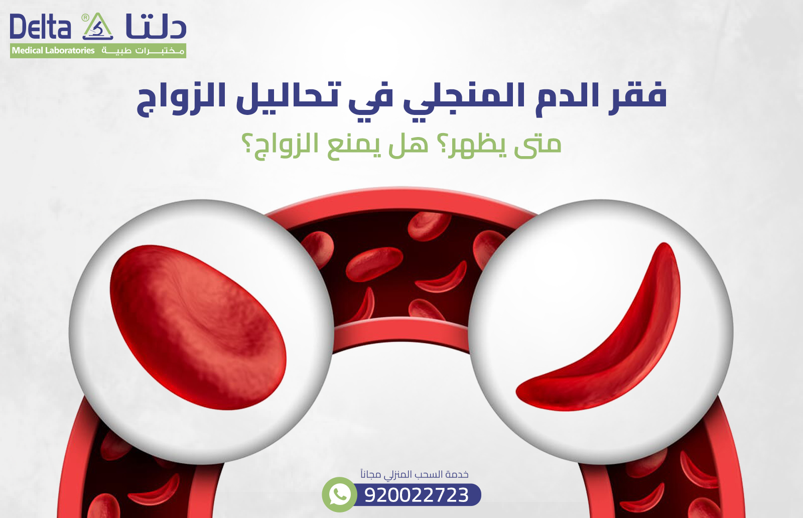 فقر الدم المنجلي في تحاليل الزواج: متى يظهر؟ هل يمنع الزواج؟