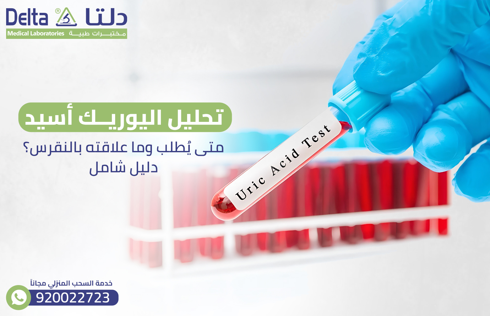 تحليل اليوريك أسيد