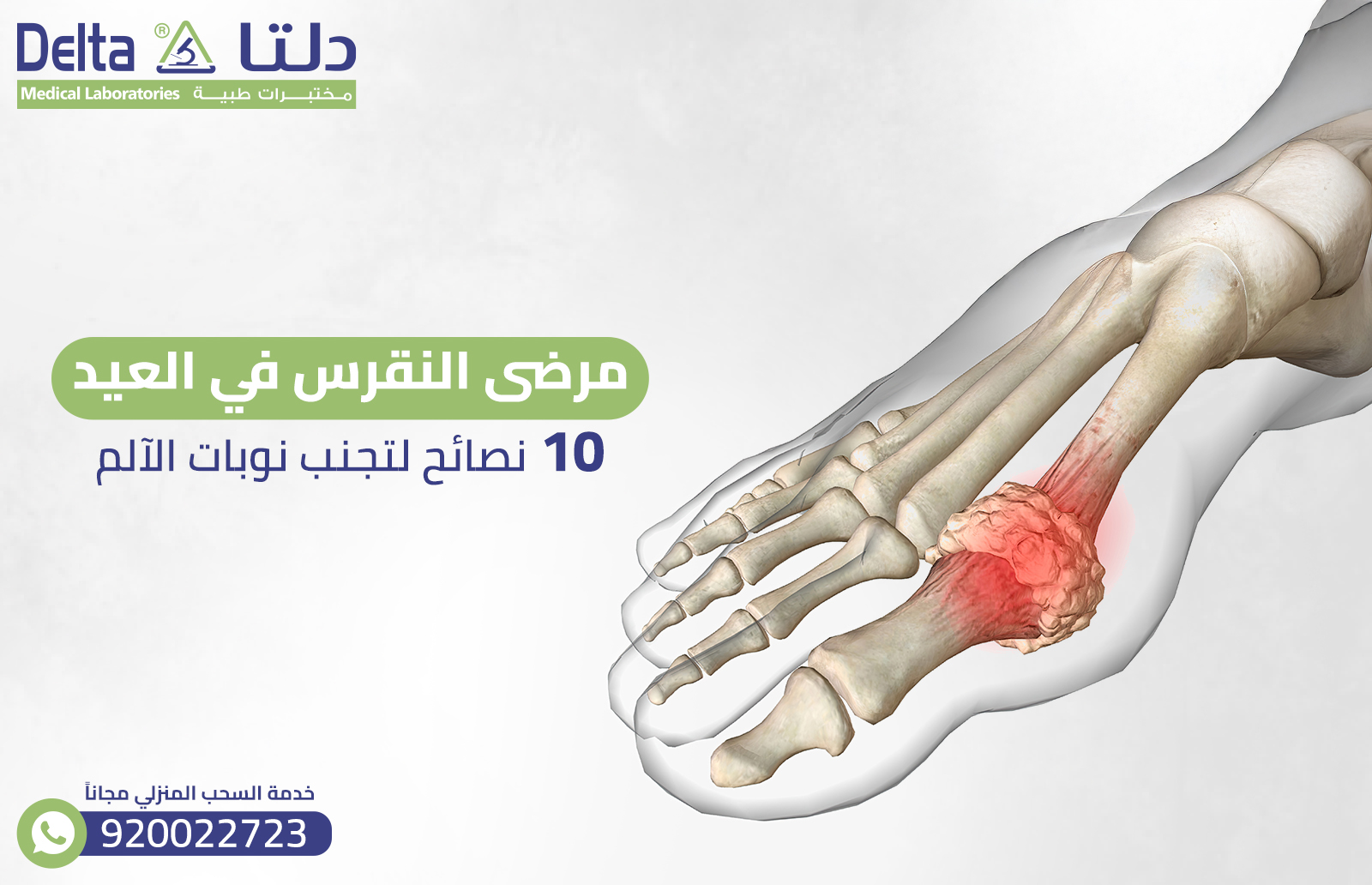 مرضى النقرس في العيد: 10 نصائح لتجنب نوبات الألم