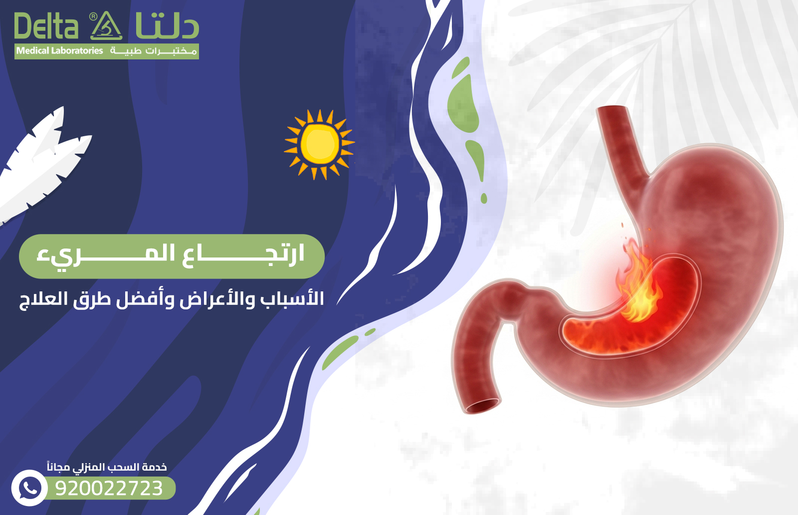 ارتجاع المريء