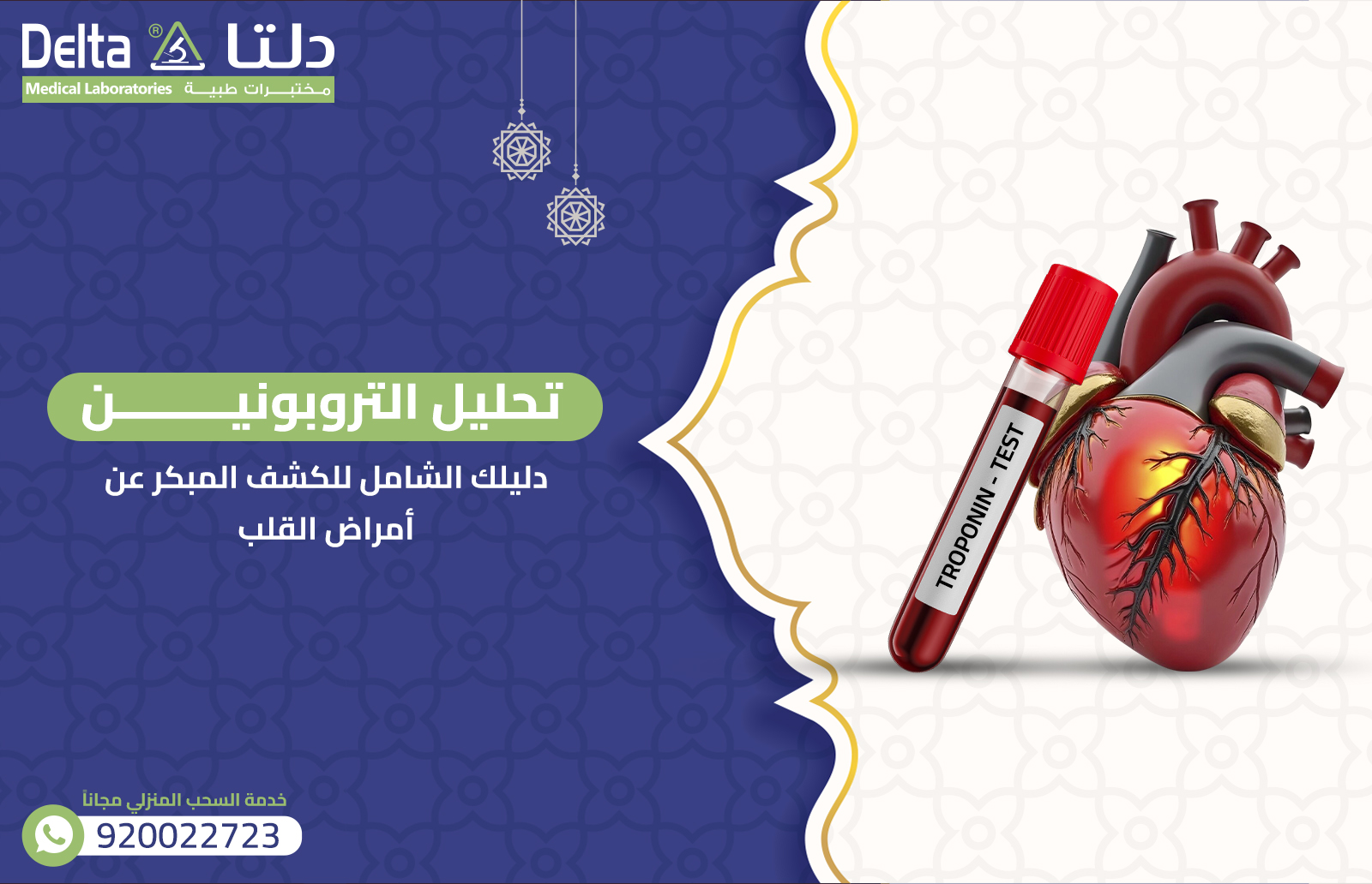 تحليل التروبونين