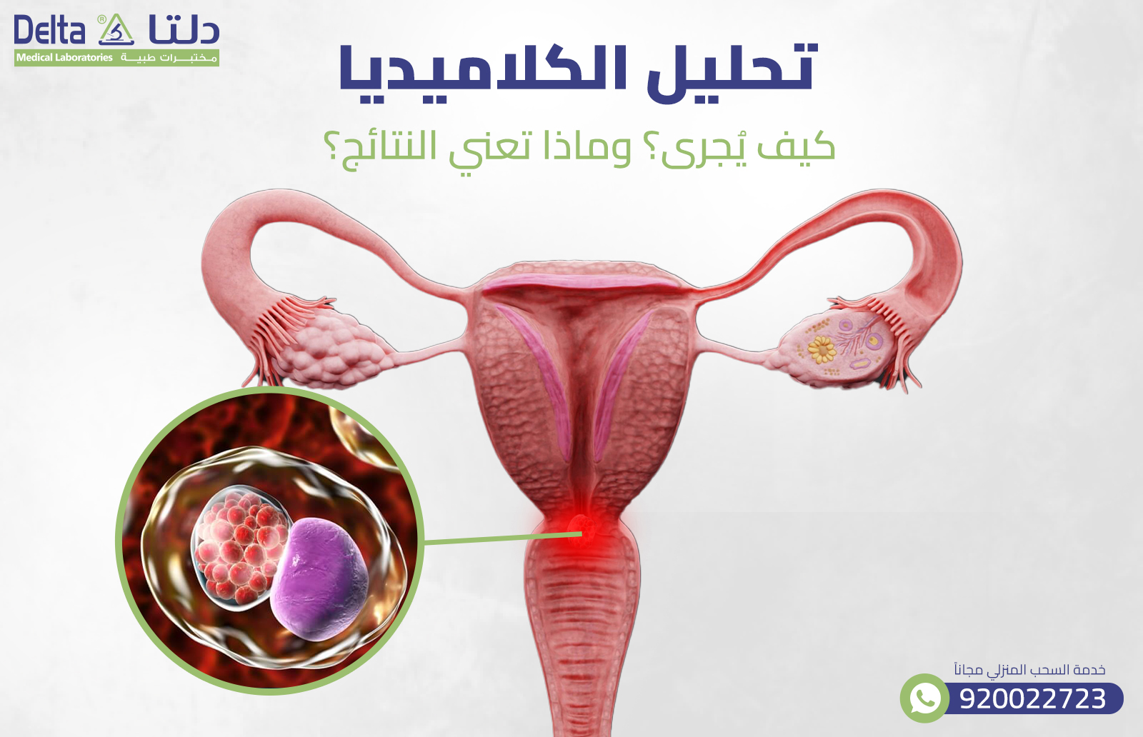 تحليل الكلاميديا: كيف يُجرى؟ وماذا تعني النتائج؟