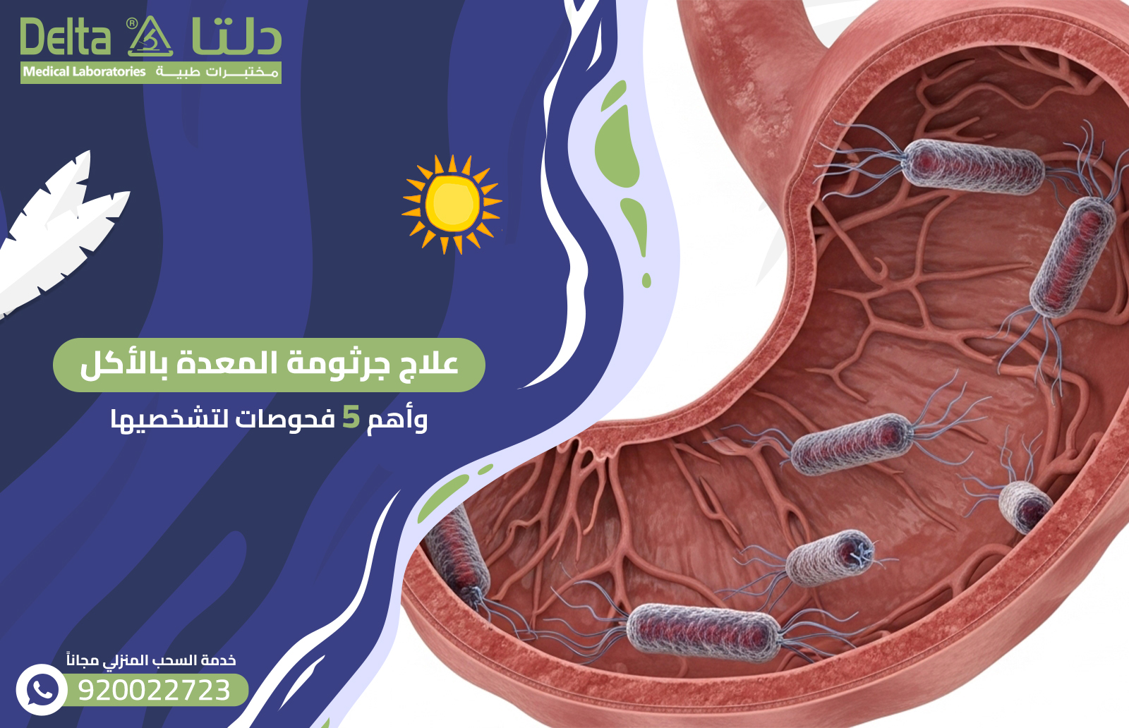 علاج جرثومة المعدة