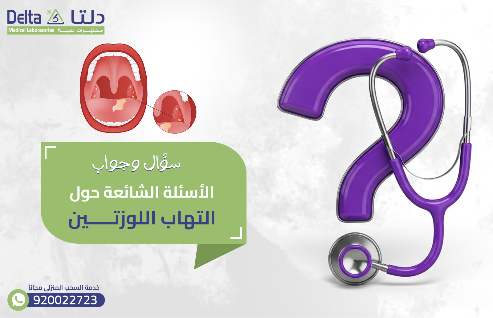 التهاب اللوزتين